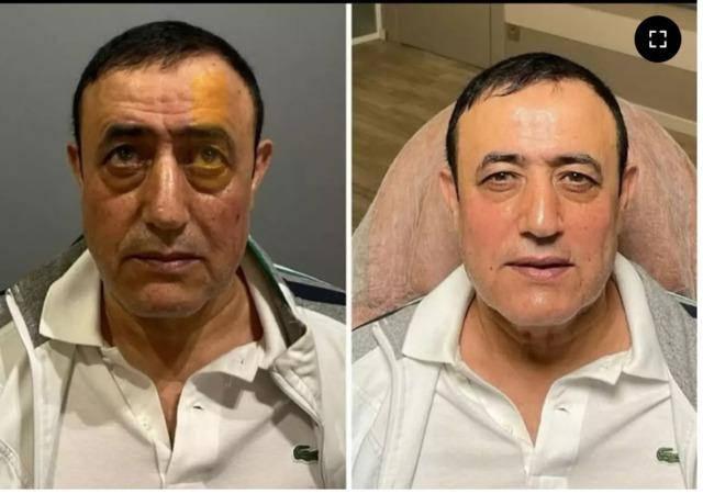 Yüzündeki değişim dikkat çekti! Mahmut Tuncer'in son hali sosyal medyanın diline düştü